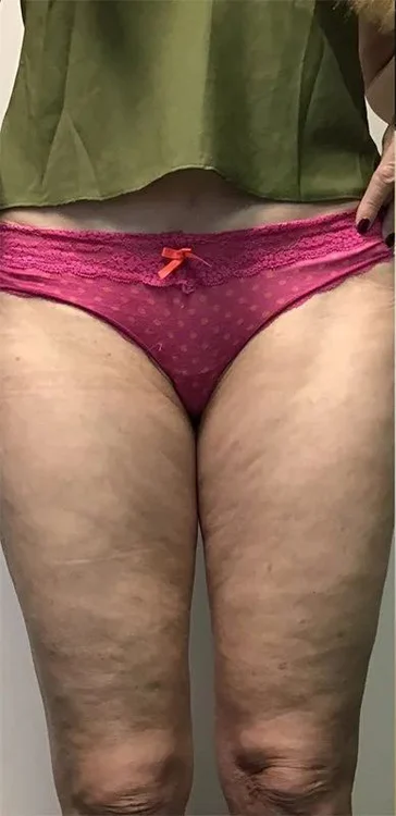 Before transformation