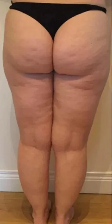 Before transformation